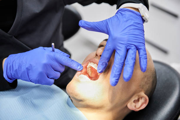 Best Emergency Tooth Extraction in Fairbank, IA